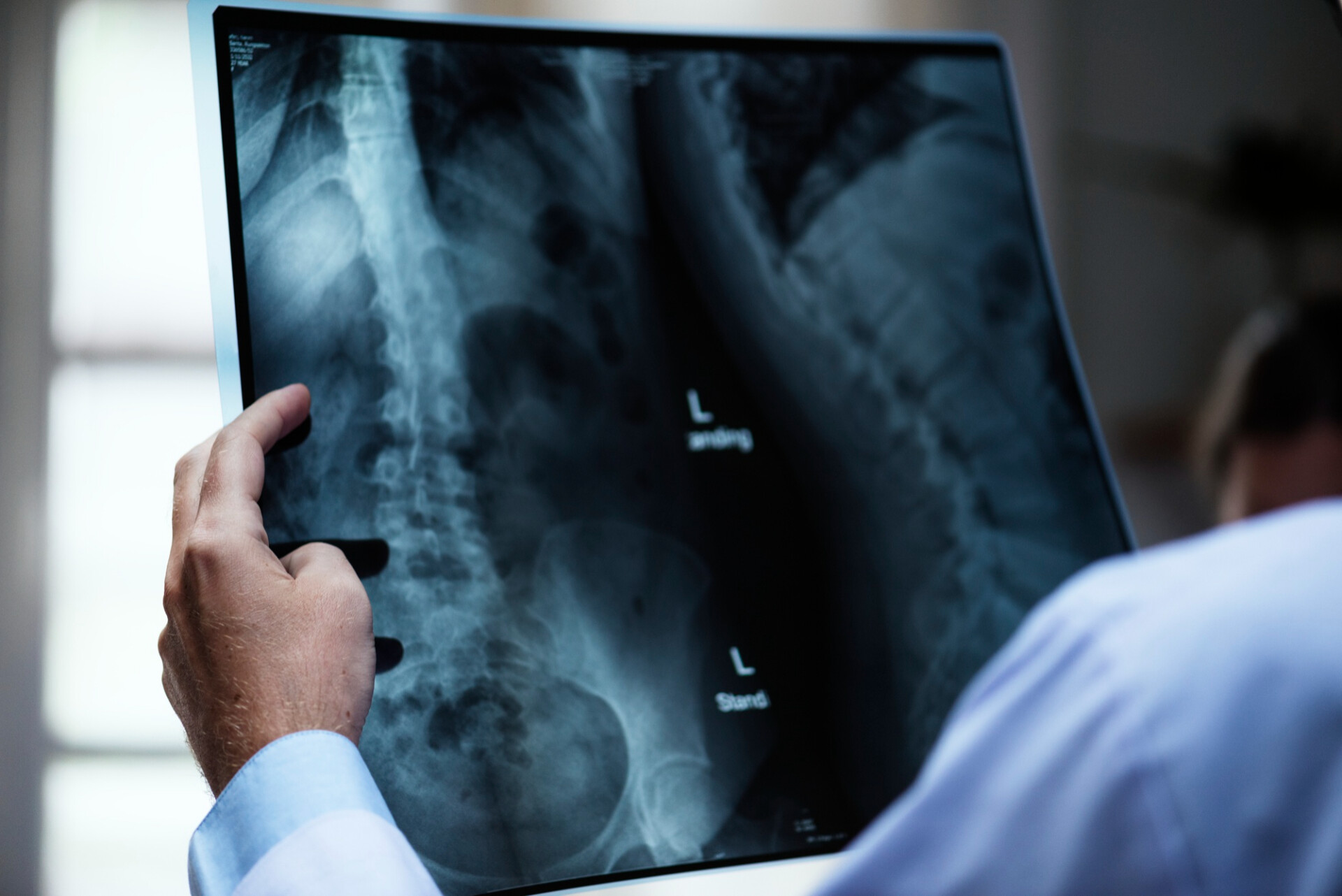 Radiología de columna